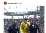 拜仁新星穆西亚拉腓骨骨折，将缺阵至少四个月！的简单介绍